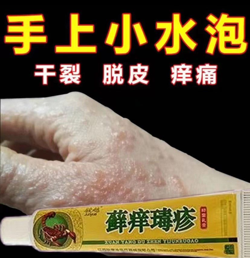 汗孢专用膏干燥皮肤手上小水泡手足脱皮膏手指上起皮抑菌全身痒