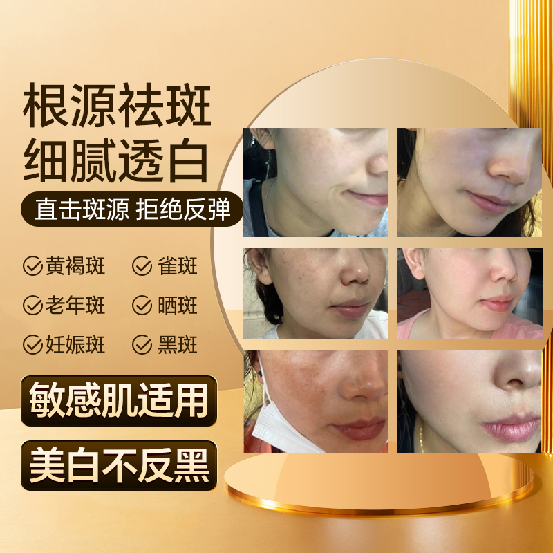 宝藏（拍一发二）JACY533祛1班1液美白精华2024新款白蓝
