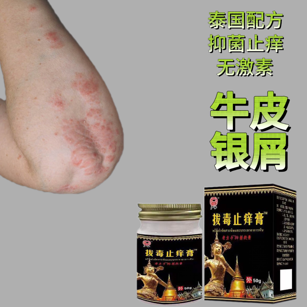 舒缓拔毒止痒膏正品皮肤抑菌清凉止痒王全身手脚快速止痒草本乳膏