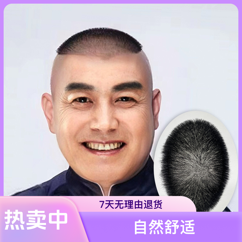 头顶补发超薄头顶补发片生物头皮男士假发片柔软真实持久郭德纲高