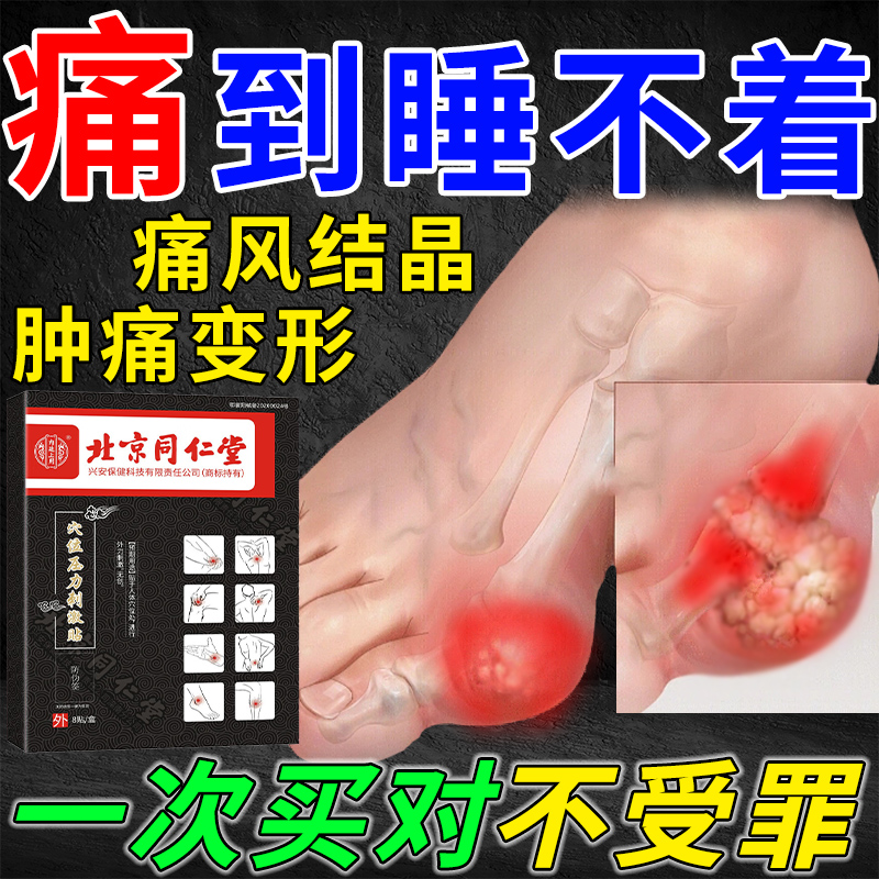 内廷上用痛风手脚指关节肿痛变形尿酸高北京同仁堂穴位压力刺激贴