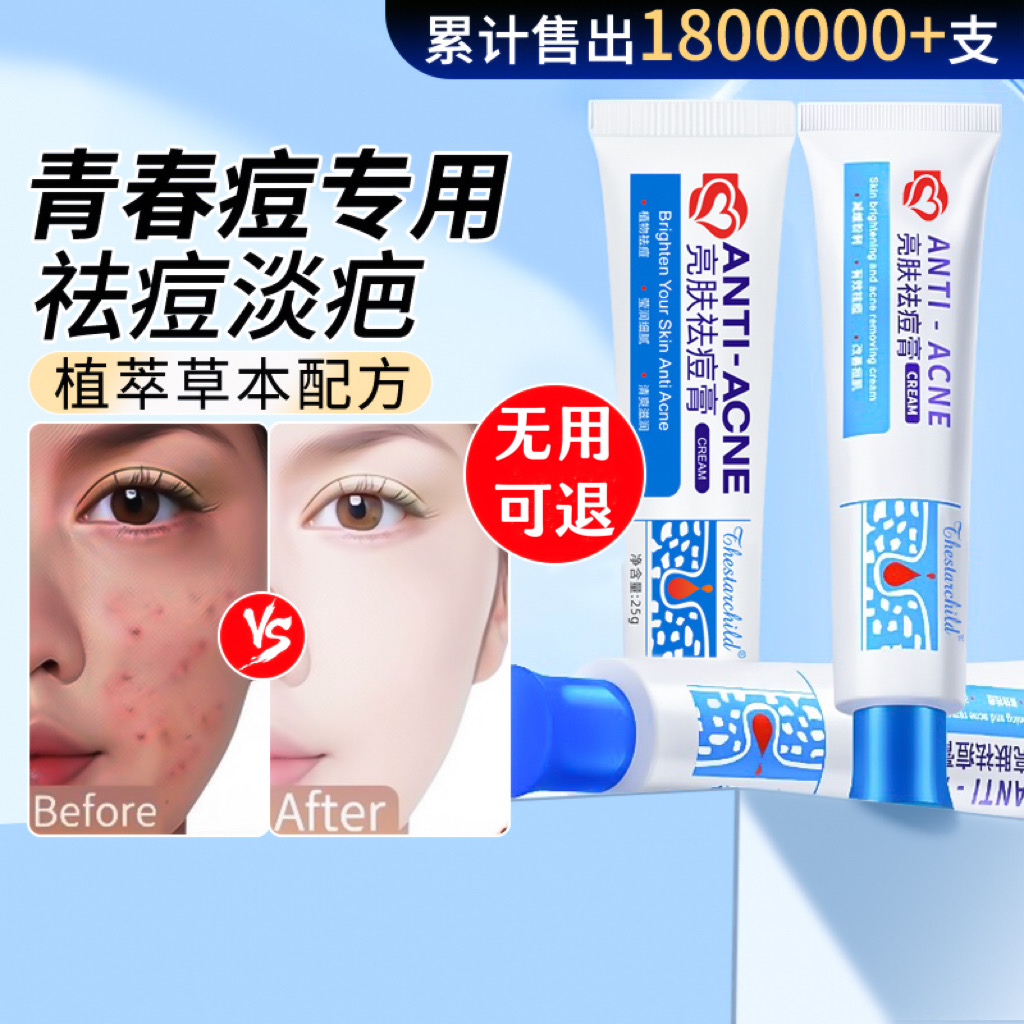 祛痘膏青春去黑头粉改善刺淡化痘印修复收缩毛孔补水保湿提亮肤色
